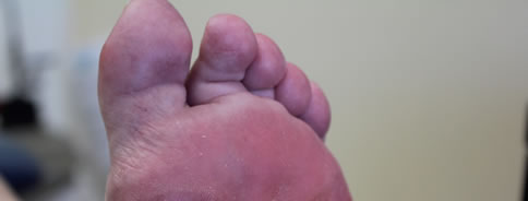 Trigger Toes