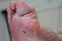 Trigger Toe 